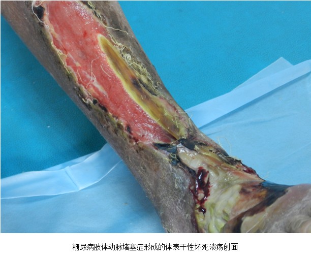 Stake官方·(中国区)网站入口